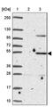 Zinc Finger Protein 736 antibody, PA5-63932, Invitrogen Antibodies, Western Blot image 