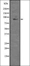 Actin Related Protein 2/3 Complex Subunit 5 antibody, orb336759, Biorbyt, Western Blot image 