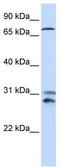 Tousled Like Kinase 2 antibody, TA344371, Origene, Western Blot image 