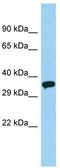 Olfactory Receptor Family 51 Subfamily V Member 1 antibody, TA332304, Origene, Western Blot image 