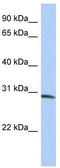 Zinc Finger FYVE-Type Containing 28 antibody, TA339745, Origene, Western Blot image 