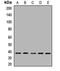 Capping Actin Protein Of Muscle Z-Line Subunit Alpha 1 antibody, orb412203, Biorbyt, Western Blot image 