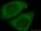 Eukaryotic translation initiation factor 2-alpha kinase 1 antibody, 20499-1-AP, Proteintech Group, Immunofluorescence image 