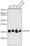 Protein Phosphatase 3 Regulatory Subunit B, Beta antibody, GTX32805, GeneTex, Western Blot image 