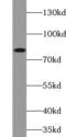 ATP Binding Cassette Subfamily B Member 7 antibody, FNab00033, FineTest, Western Blot image 