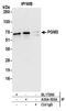 Phosphoacetylglucosamine mutase antibody, A304-555A, Bethyl Labs, Immunoprecipitation image 