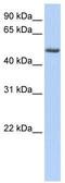 Pleckstrin homology-like domain family A member 1 antibody, TA334416, Origene, Western Blot image 
