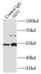 Rho guanine nucleotide exchange factor 25 antibody, FNab03416, FineTest, Immunoprecipitation image 