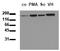 EGFR antibody, AM00030PU-N, Origene, Western Blot image 