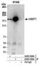 UDP-Glucose Glycoprotein Glucosyltransferase 1 antibody, A305-530A, Bethyl Labs, Immunoprecipitation image 