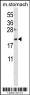 Oligosaccharyltransferase complex subunit OSTC antibody, 56-424, ProSci, Western Blot image 
