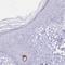 Psoriasis Susceptibility 1 Candidate 2 antibody, NBP2-32589, Novus Biologicals, Immunohistochemistry frozen image 