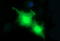 Phospholipase A And Acyltransferase 3 antibody, M34042, Boster Biological Technology, Immunofluorescence image 