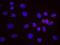 DNA replication licensing factor MCM2 antibody, NB100-244, Novus Biologicals, Proximity Ligation Assay image 