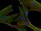 Clathrin Heavy Chain antibody, AM03115PU-N, Origene, Immunofluorescence image 