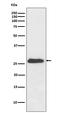 N-Ribosyldihydronicotinamide:Quinone Reductase 2 antibody, M03112, Boster Biological Technology, Western Blot image 
