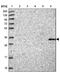 Transmembrane Protein 255B antibody, NBP1-81175, Novus Biologicals, Western Blot image 