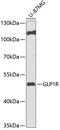 Glucagon-like peptide 1 receptor antibody, GTX57214, GeneTex, Western Blot image 