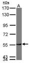Phosphoacetylglucosamine mutase antibody, TA308127, Origene, Western Blot image 