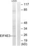 Eukaryotic Translation Initiation Factor 4E Family Member 3 antibody, LS-C119969, Lifespan Biosciences, Western Blot image 