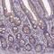5',3'-Nucleotidase, Mitochondrial antibody, NBP1-92203, Novus Biologicals, Immunohistochemistry frozen image 