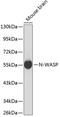 Neural Wiskott-Aldrich syndrome protein antibody, 13-058, ProSci, Western Blot image 