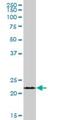 FKBP Prolyl Isomerase 11 antibody, H00051303-B01P, Novus Biologicals, Western Blot image 
