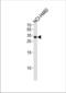 Achaete-Scute Family BHLH Transcription Factor 1 antibody, TA324677, Origene, Western Blot image 