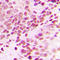 Histone H3 antibody, LS-C354321, Lifespan Biosciences, Immunohistochemistry paraffin image 