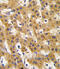 Pyruvate Dehydrogenase Complex Component X antibody, abx031493, Abbexa, Immunohistochemistry paraffin image 