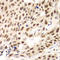 Cyclin D1 antibody, LS-C331409, Lifespan Biosciences, Immunohistochemistry paraffin image 
