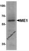 Malic Enzyme 1 antibody, 7721, ProSci Inc, Western Blot image 