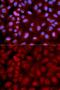 Synuclein Gamma antibody, GTX55635, GeneTex, Immunocytochemistry image 
