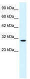 Cyclin Dependent Kinase 1 antibody, TA330359, Origene, Western Blot image 