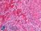 PCNA Clamp Associated Factor antibody, LS-C317503, Lifespan Biosciences, Immunohistochemistry paraffin image 