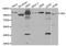 Hexokinase-2 antibody, LS-B13358, Lifespan Biosciences, Western Blot image 