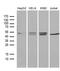 Ribonucleotide Reductase Regulatory Subunit M2 antibody, TA810548S, Origene, Western Blot image 