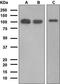 Progesterone Receptor antibody, orb106338, Biorbyt, Western Blot image 