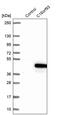 Coiled-Coil Domain Containing 189 antibody, PA5-59740, Invitrogen Antibodies, Western Blot image 