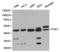 Phosphoglycerate Kinase 1 antibody, TA327222, Origene, Western Blot image 