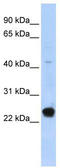 Cilia And Flagella Associated Protein 20 antibody, TA335647, Origene, Western Blot image 