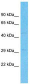 Unc-119 Lipid Binding Chaperone B antibody, TA330814, Origene, Western Blot image 