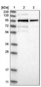 Leucine Rich Repeats And Calponin Homology Domain Containing 1 antibody, NBP1-90629, Novus Biologicals, Western Blot image 