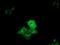 Cytoplasmic dynein 1 light intermediate chain 1 antibody, GTX84594, GeneTex, Immunocytochemistry image 