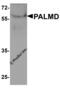 Palmdelphin antibody, 8237, ProSci Inc, Western Blot image 
