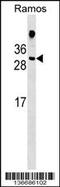 HDGF Like 1 antibody, 59-008, ProSci, Western Blot image 