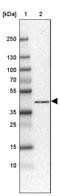 Histone PARylation Factor 1 antibody, PA5-60371, Invitrogen Antibodies, Western Blot image 