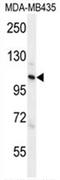 Zinc Finger CCCH-Type Containing 3 antibody, AP54622PU-N, Origene, Western Blot image 