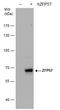ZFP57 Zinc Finger Protein antibody, GTX631717, GeneTex, Western Blot image 