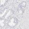 Carbonic anhydrase 2 antibody, HPA001550, Atlas Antibodies, Immunohistochemistry paraffin image 